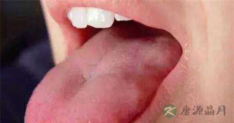 舌苔厚和胃有关吗