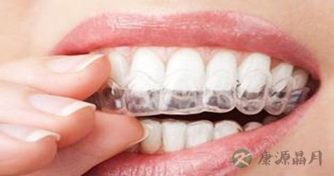 矫正牙齿后的饮食