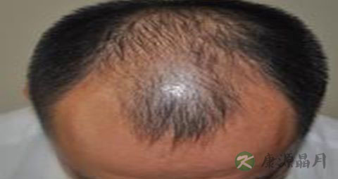 男性早衰的原因有哪些