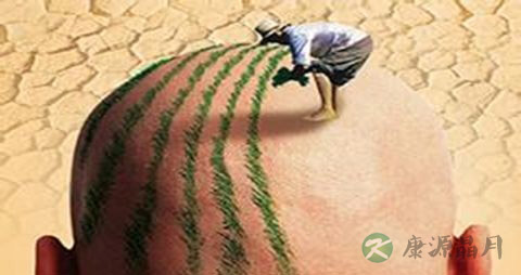 有什么可以治疗脱发 有什么可以治疗脱发