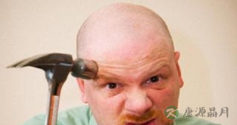 治疗脱发最有效的方法 治疗脱发最有效的方法