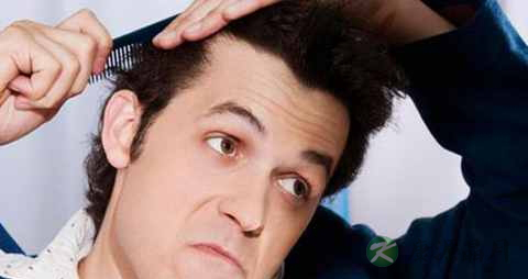 遗传脱发怎么办 遗传脱发怎么办