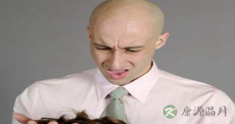 脂溢性脱发用药