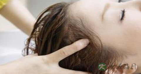 怎么治脂溢性脱发