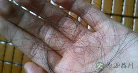 肾虚脱发能恢复吗 肾虚脱发能恢复吗