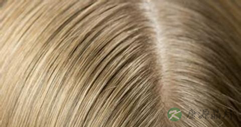 吃什么头发长得快 吃什么头发长得快