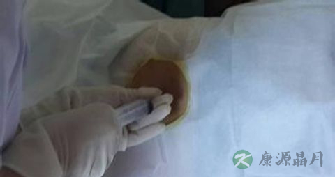 抽骨髓后吃什么 抽骨髓后吃什么