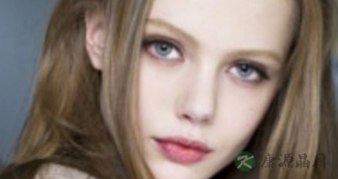 头顶掉发吃什么