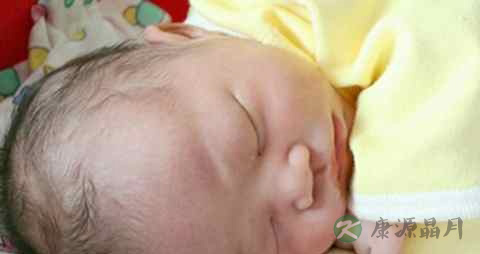 小孩掉头发怎么办 小孩掉头发怎么办