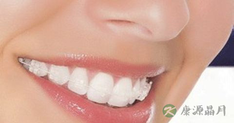 矫正牙齿吃什么好 矫正牙齿吃什么好