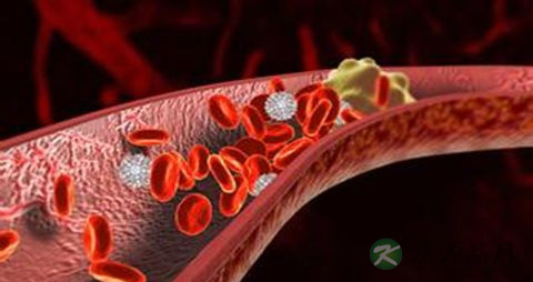 治疗血栓吃什么药 治疗血栓吃什么药