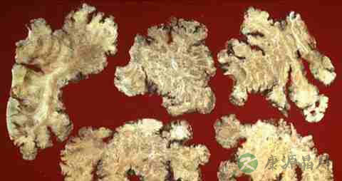 前额掉头发怎么办