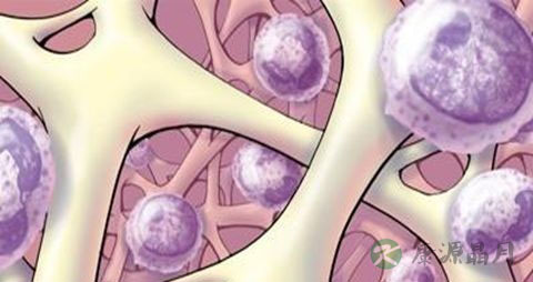 骨髓纤维化的饮食 骨髓纤维化的饮食