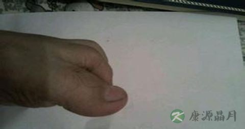 脚趾骨折吃什么好 脚趾骨折吃什么好
