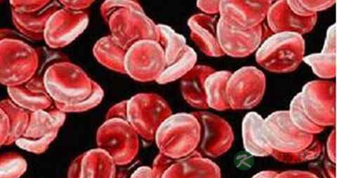 深静脉血栓饮食 深静脉血栓饮食