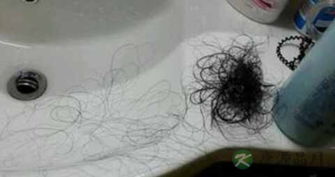 如何治疗严重脱发