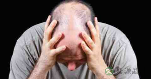 失眠脱发吃什么药 失眠脱发吃什么药