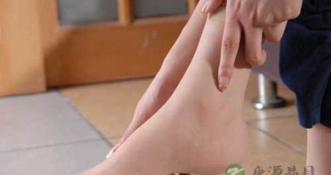 脚骨折吃什么补品 脚骨折吃什么补品