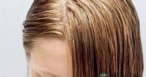 头发油腻脱发怎么办 头发油腻脱发怎么办