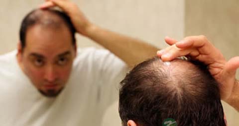 防脱发生发产品 防脱发生发产品