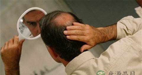 肾虚脱发吃些什么 肾虚脱发吃些什么