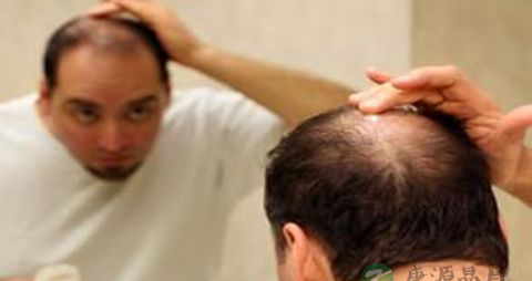 有什么方法治疗脱发 有什么方法治疗脱发