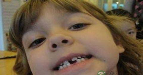 牙齿掉了吃什么 牙齿掉了吃什么