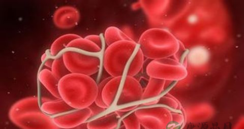 治疗血栓吃什么药 治疗血栓吃什么药