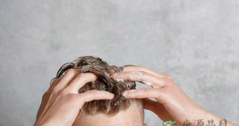 遗传脱发有救吗 遗传脱发有救吗