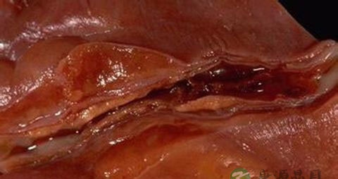 血栓适合吃什么 血栓适合吃什么