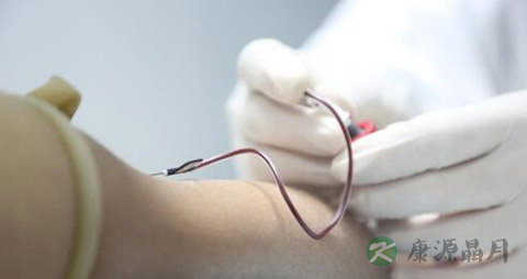 血脂稠的治疗方法 血脂稠的治疗方法