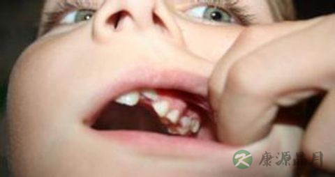 牙齿松动吃什么 牙齿松动吃什么