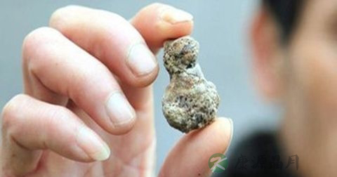 肾结石如何排石