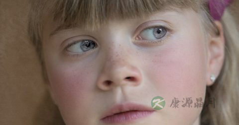 儿童甲肝病的症状