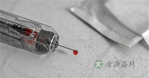 甲肝的体检指标是什么