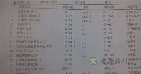 肝功检测能测出乙肝吗