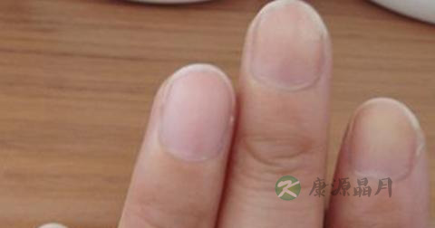 哪些食物可以排肝毒