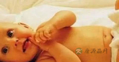 重度黄疸怎么办
