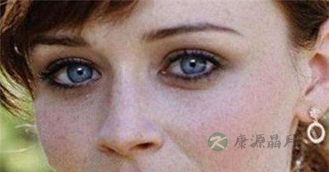 女性更年期的治疗