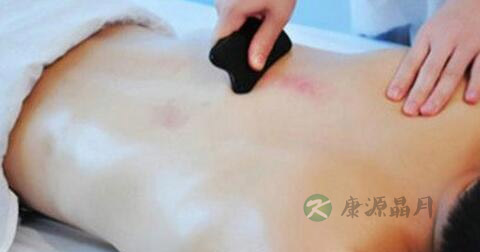 中医去除痤疮怎么样