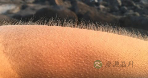 肘部皮肤粗糙怎么办