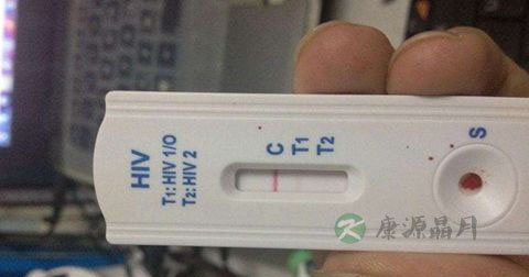 爱滋病检测试纸结果准确吗