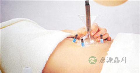 前列腺增生最佳治疗方法