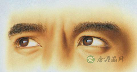 男人黑眼圈是怎么形成的