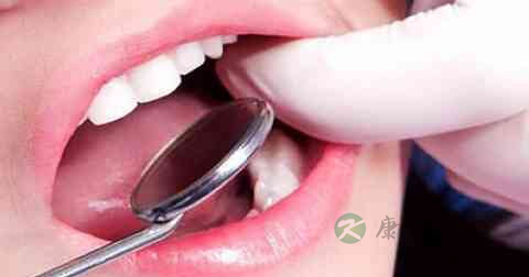 洗牙会变白吗