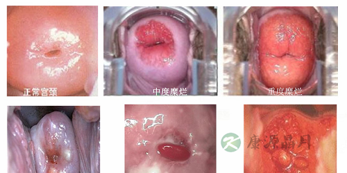 私处异味，瘙痒，干涩,怎么办