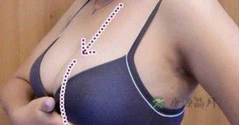 女性怎样增大乳房