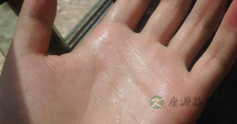 睡觉时手心出汗是怎么回事