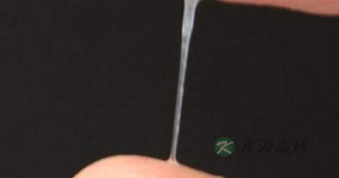 妇科血检查什么