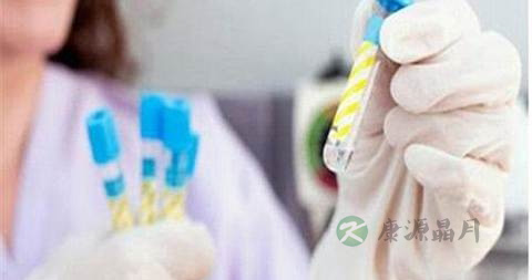 化验白带常规要多长时间